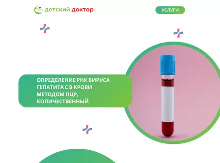Определение РНК вируса гепатита С в крови методом ПЦР, количественный